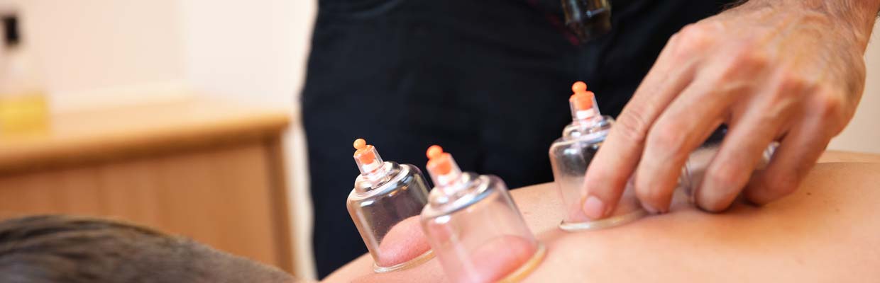 Sports Massage Cupping in Bournemouth